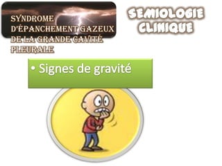 Syndrome
d’épanchement gazeux
de la grande cavité
pleurale
 