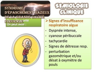 Syndrome
d’épanchement gazeux
de la grande cavité
pleurale

                  -   Dyspnée intense,
                  -   cyanose péribuccale
                  -   tachycardie
                  -   Signes de détresse resp.
                  -   perturbation
                      gazométrique et/ou
                      désat à oxymètre de
                      pouls
 