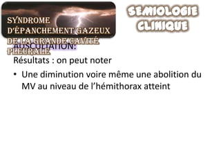 Syndrome
d’épanchement gazeux
de la grande cavité
 AUSCULTATION:
pleurale
 Résultats : on peut noter
 • Une diminution voire même une abolition du
   MV au niveau de l’hémithorax atteint
 