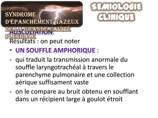 Syndrome
d’épanchement gazeux
de la grande cavité
 AUSCULTATION:
pleurale
 Résultats : on peut noter
                                 :
 - qui traduit la transmission anormale du
   souffle laryngotrachéal à travers le
   parenchyme pulmonaire et une collection
   aérique suffisament vaste
 - on le compare au bruit obtenu en soufflant
   dans un récipient large à goulot étroit
 