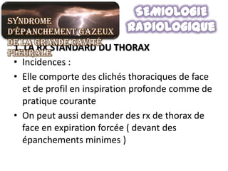 Syndrome
d’épanchement gazeux
de la grande cavité
 1. LA RX STANDARD DU THORAX
pleurale
 • Incidences :
 • Elle comporte des clichés thoraciques de face
   et de profil en inspiration profonde comme de
   pratique courante
 • On peut aussi demander des rx de thorax de
   face en expiration forcée ( devant des
   épanchements minimes )
 