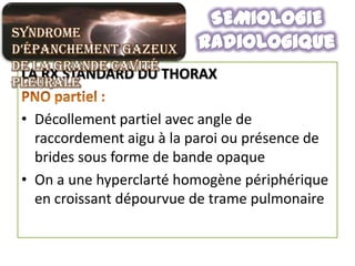 Syndrome
d’épanchement gazeux
de la grande cavité
 LA RX STANDARD DU THORAX
pleurale

 • Décollement partiel avec angle de
   raccordement aigu à la paroi ou présence de
   brides sous forme de bande opaque
 • On a une hyperclarté homogène périphérique
   en croissant dépourvue de trame pulmonaire
 