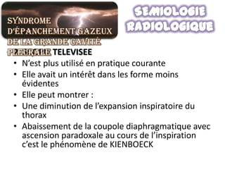 Syndrome
d’épanchement gazeux
de la grande cavité
pleurale TELEVISEE
 2. SCOPIE
 • N’est plus utilisé en pratique courante
 • Elle avait un intérêt dans les forme moins
   évidentes
 • Elle peut montrer :
 • Une diminution de l’expansion inspiratoire du
   thorax
 • Abaissement de la coupole diaphragmatique avec
   ascension paradoxale au cours de l’inspiration
   c’est le phénomène de KIENBOECK
 