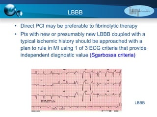 LBBB Direct PCI may be preferable to fibrinolytic therapy Pts with new or presumably new LBBB coupled with a typical ischemic history should be approached with a plan to rule in MI using 1 of 3 ECG criteria that provide independent diagnostic value  (Sgarbossa criteria) LBBB 