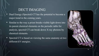 Recent Avancement of CT Scan | PPTX