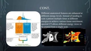 Recent Avancement of CT Scan | PPTX