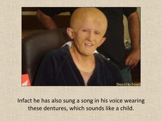 Infact he has also sung a song in his voice wearing these dentures, which sounds like a child. 