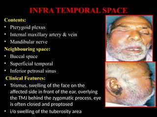 space infection in oral [Autosaved].pptx