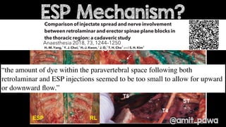 ESP block - future direction and remaining questions | PDF