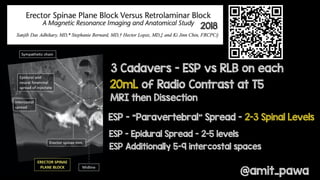 ESP block - future direction and remaining questions | PDF