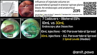 ESP block - future direction and remaining questions | PDF
