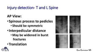 amit ppt spine xray injury protocol.pptx