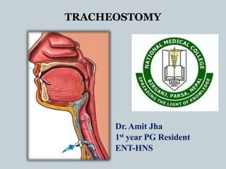 TRACHEOSTOMY
Dr. Amit Jha
1st year PG Resident
ENT-HNS
 