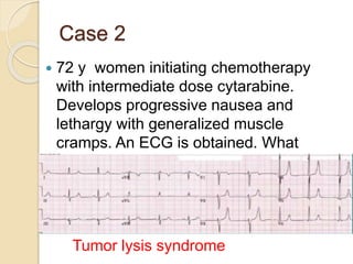 Case 2
 72 y women initiating chemotherapy
with intermediate dose cytarabine.
Develops progressive nausea and
lethargy with generalized muscle
cramps. An ECG is obtained. What
diagnosis is concerning?
Tumor lysis syndrome
 