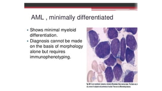 Acute myeloid leukemia, its clinical features | PPTX