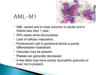 Aml and all by asif.ppt.jjj
