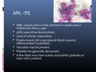 leukemia: Aml and all by asif | PPT