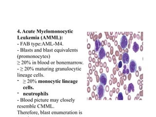 4. Acute Myelomonocytic
Leukemia (AMML):
- FAB type:AML-M4.
- Blasts and blast equivalents
(promonocytes)
≥ 20% in blood or bonemarrow.
- ≥ 20% maturing granulocytic
lineage cells.
- ≥ 20% monocytic lineage
cells.
- neutrophils
- Blood picture may closely
resemble CMML.
Therefore, blast enumeration is
 