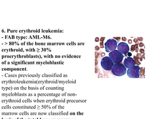 6. Pure erythroid leukemia:
- FAB type: AML-M6.
- > 80% of the bone marrow cells are
erythroid, with ≥ 30%
proerythroblasts), with no evidence
of a significant myeloblastic
component.
- Cases previously classified as
erythroleukemia(erythroid/myeloid
type) on the basis of counting
myeloblasts as a percentage of non-
erythroid cells when erythroid precursor
cells constituted ≥ 50% of the
marrow cells are now classified on the
 