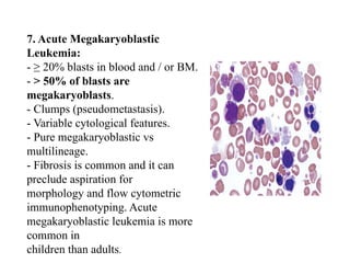 7. Acute Megakaryoblastic
Leukemia:
- ≥ 20% blasts in blood and / or BM.
- > 50% of blasts are
megakaryoblasts.
- Clumps (pseudometastasis).
- Variable cytological features.
- Pure megakaryoblastic vs
multilineage.
- Fibrosis is common and it can
preclude aspiration for
morphology and flow cytometric
immunophenotyping. Acute
megakaryoblastic leukemia is more
common in
children than adults.
 
