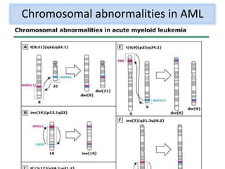 Acute Leukemia Cytogenetics | PPTX