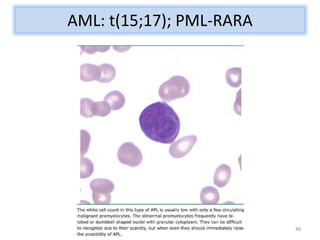 Acute Leukemia Cytogenetics | PPTX