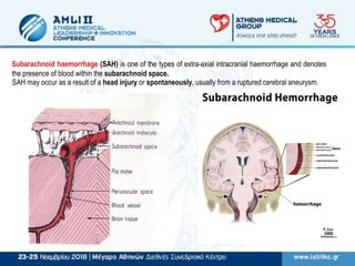 Subarachnoid haemorrhage (SAH) is one of the types of extra-axial intracranial haemorrhage and denotes
the presence of blood within the subarachnoid space.
SAH may occur as a result of a head injury or spontaneously, usually from a ruptured cerebral aneurysm.
 