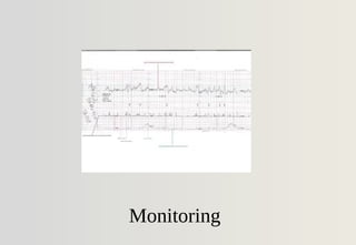 Monitoring
 