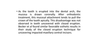 surgical and orthodontic management of impacted maxillary canines part ...