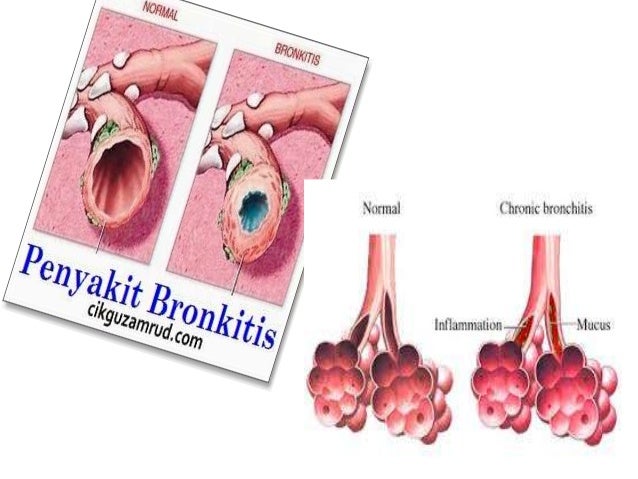 BAHAN PENCEMARAN DAN PEPARU
