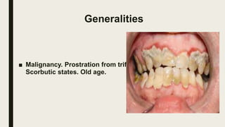 Generalities
■ Malignancy. Prostration from trifles.
Scorbutic states. Old age.
 