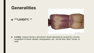 Generalities
■ ***LIVIDITY, **
■ Lividity means having a discolored, bluish appearance caused by a bruise,
congestion of b...