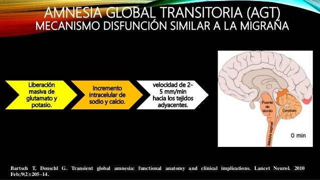 transitional global amnesia wikipedia transitional global amnesia wikipedia