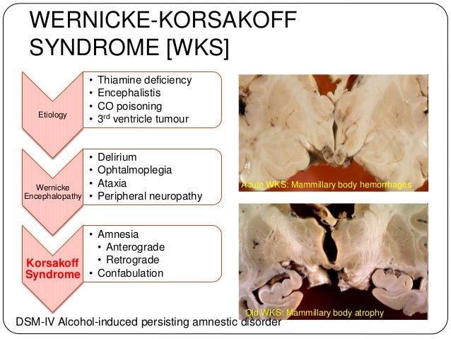 alcohol induced amnesia alcohol induced amnesia