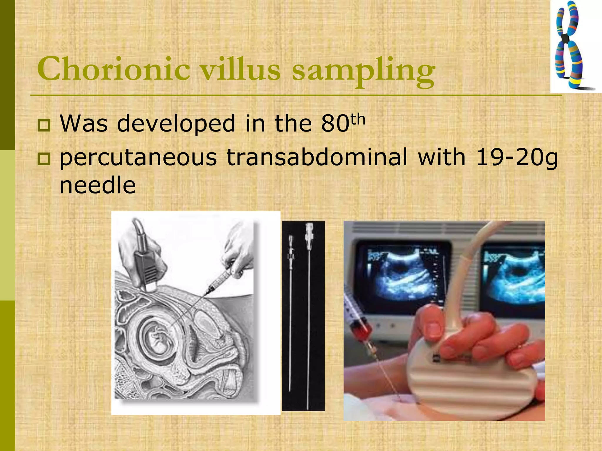 Chorionic villus sampling
 Was developed in the 80th
 percutaneous transabdominal with 19-20g
needle
 