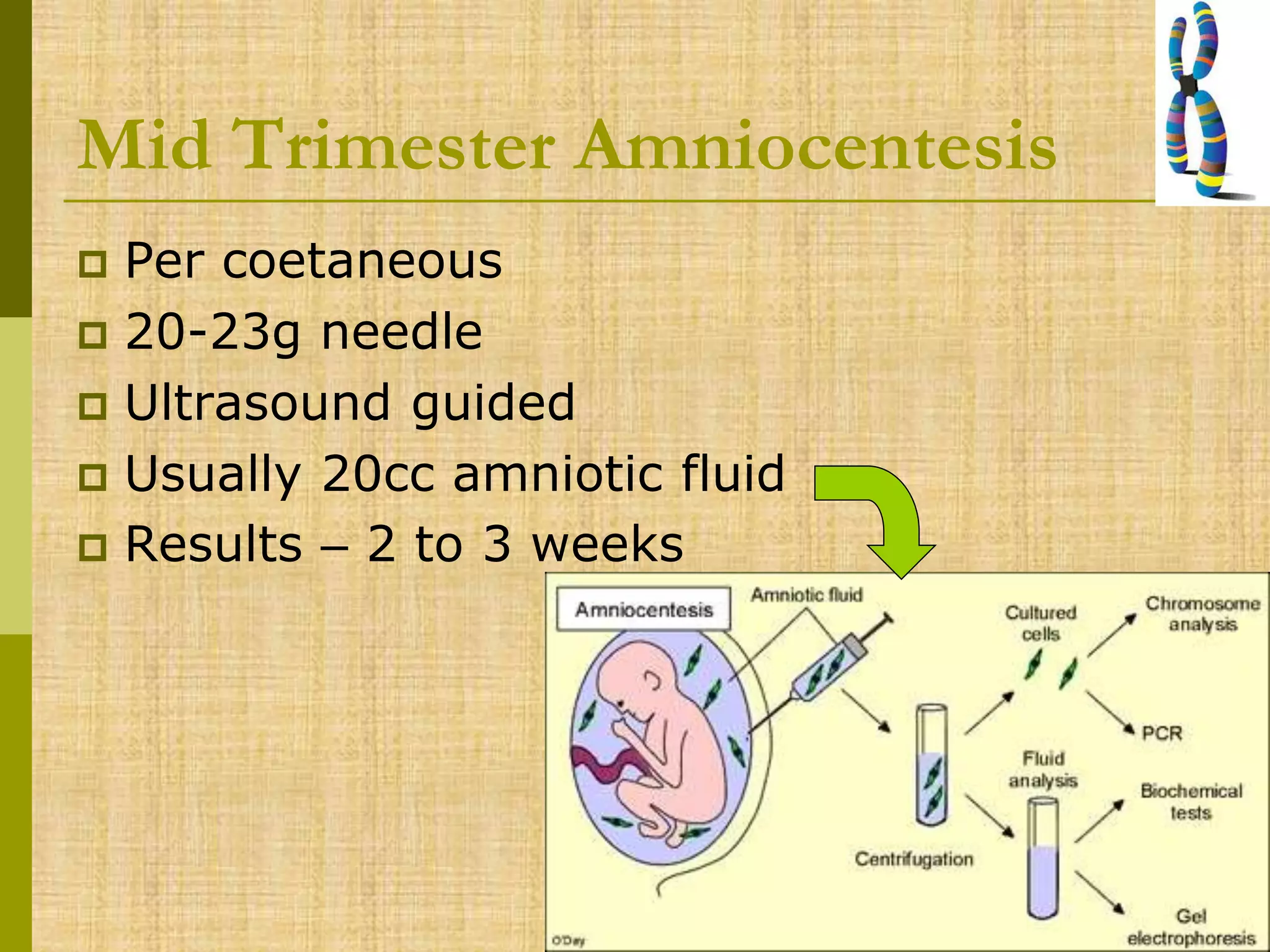 Mid Trimester Amniocentesis
 Per coetaneous
 20-23g needle
 Ultrasound guided
 Usually 20cc amniotic fluid
 Results – 2 to 3 weeks
 