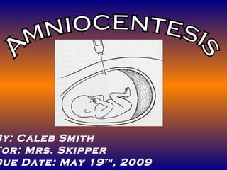 Amniocentesis By: Caleb Smith For: Mrs. Skipper Due Date: May 19 th , 2009 