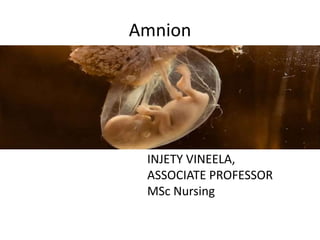 Amnion
INJETY VINEELA,
ASSOCIATE PROFESSOR
MSc Nursing
 