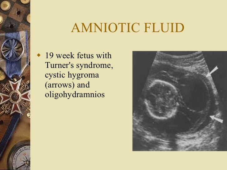 fluid weeks amniotic much 40 how fluid Amniotic