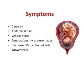 Amniotic fluid | PPT