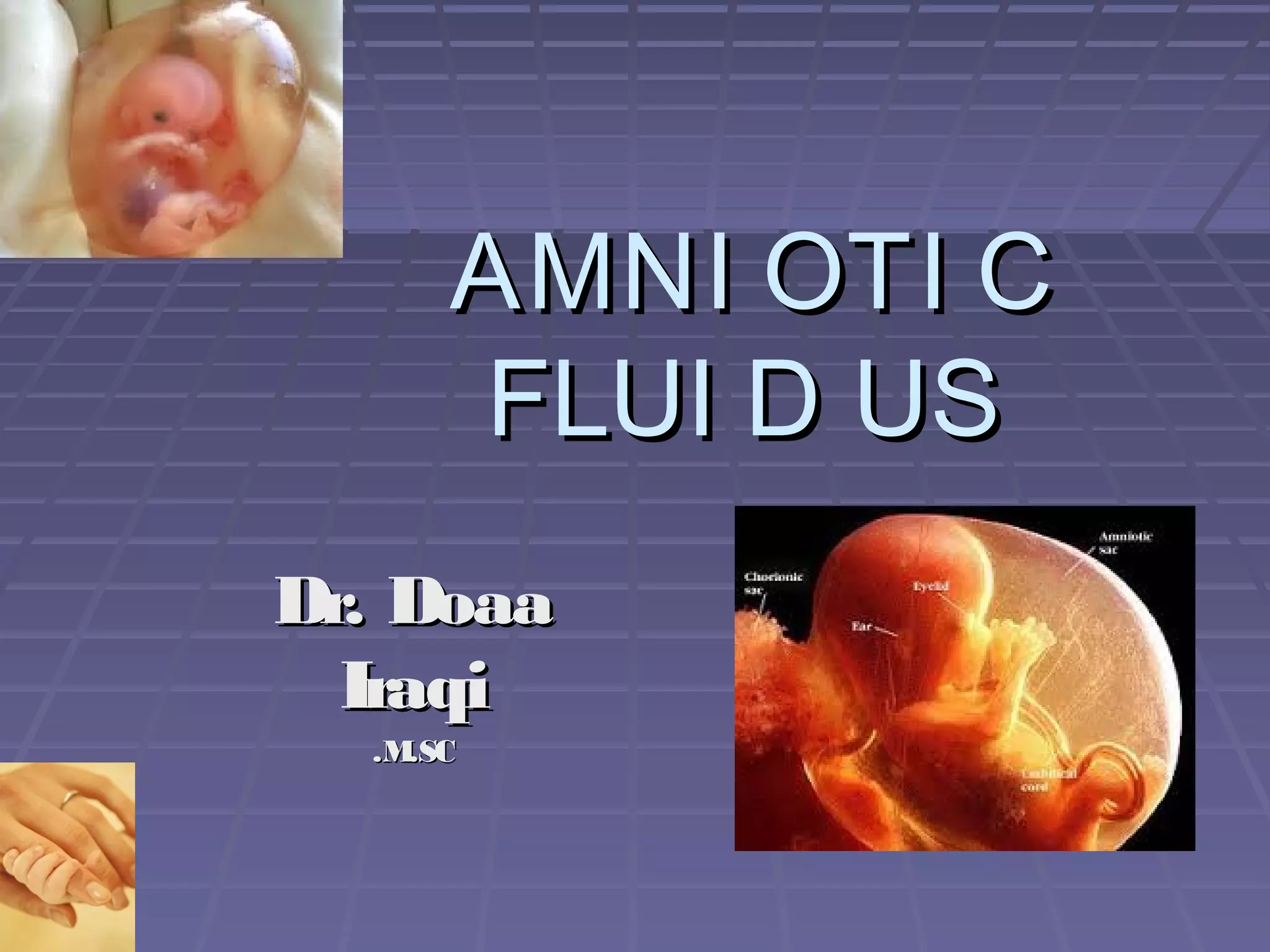Amniotic fluid ultrasound | PPT