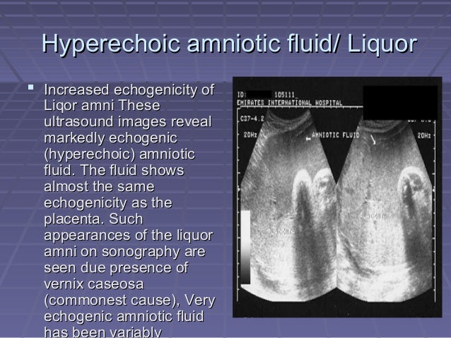 Amniotic Fluid Ultrasound