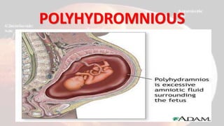 POLYHYDROMNIOUS
 