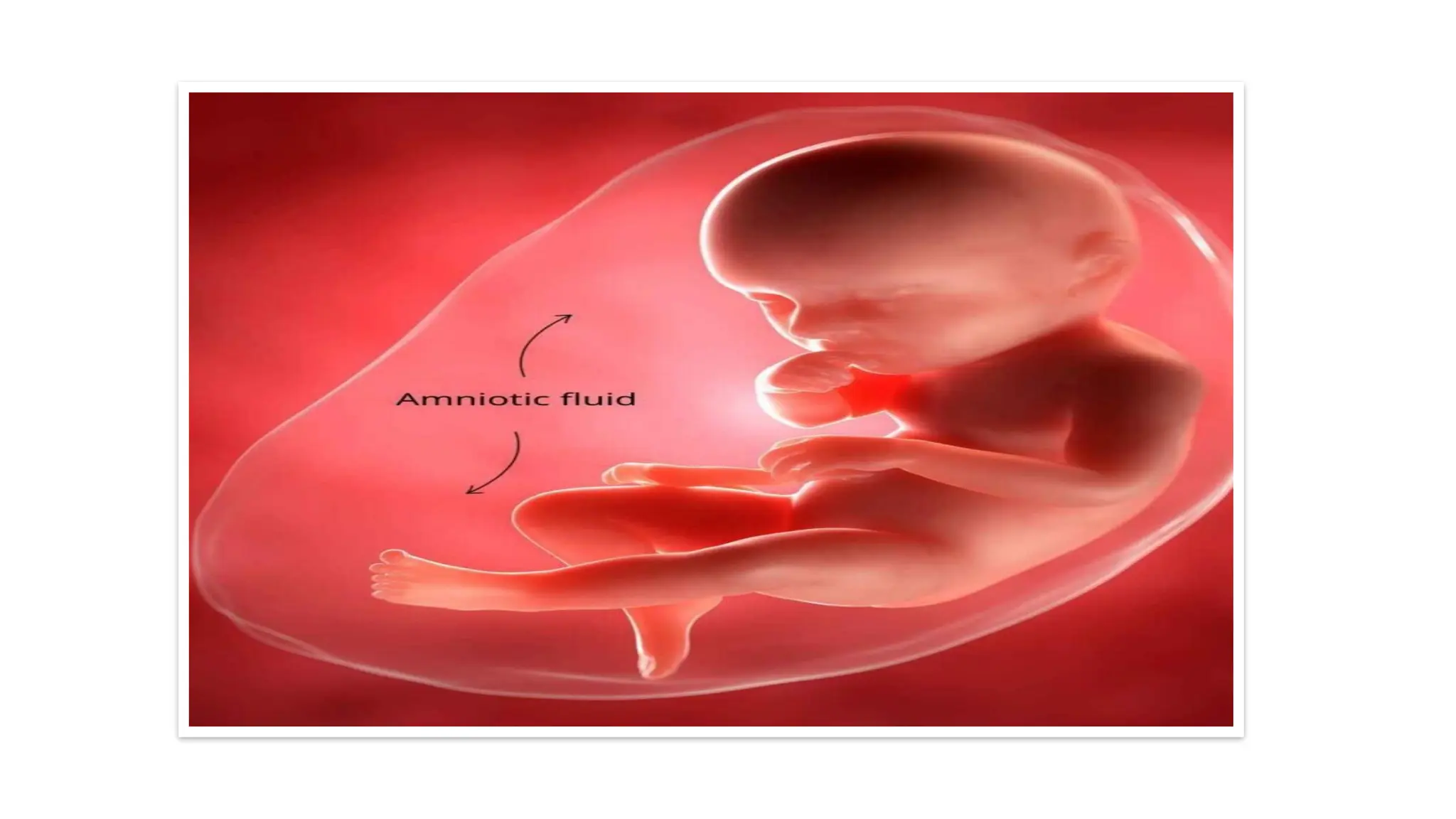 Amniotic fluid-Specimen handling and collection.pptx