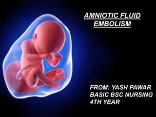 AMNIOTIC FLUID
EMBOLISM
FROM: YASH PAWAR
BASIC BSC NURSING
4TH YEAR
 