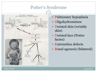 Potter’s Syndrome
5/31/2016OKEY UGWU
33
 Pulmonary hypoplasia
 Oligohydrominios
 Twisted skin (wrinkly
skin)
 Twisted face (Potter
facies)
 Extremities defects
 Renal agenesis (bilateral)
 