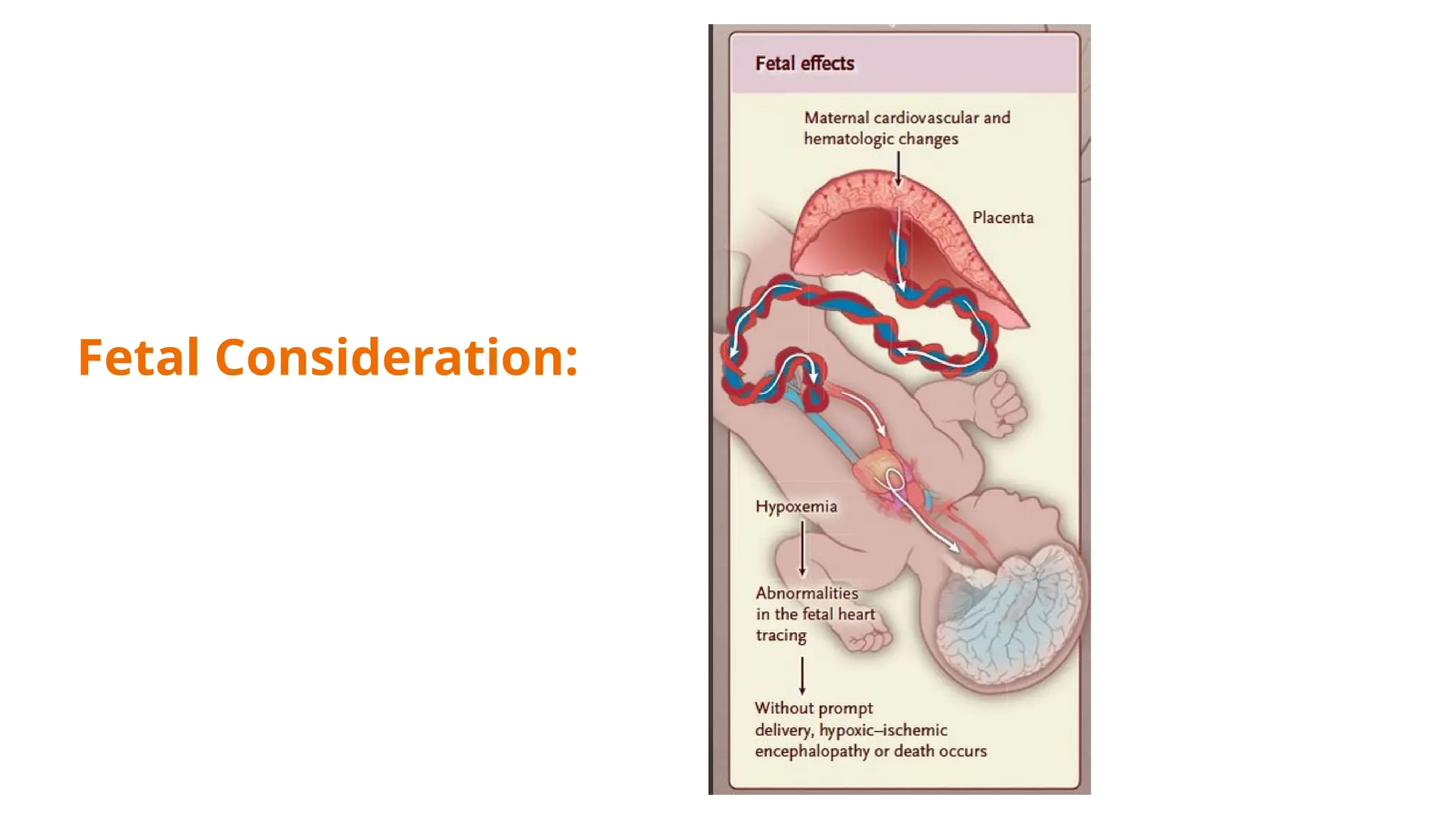 Fetal Consideration:
 