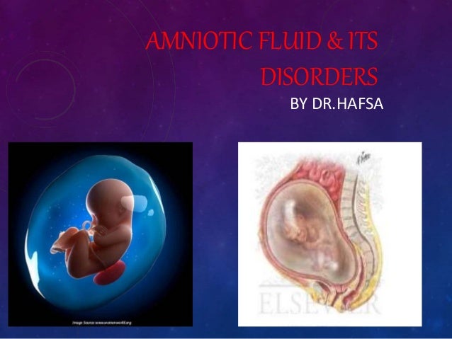 high amniotic fluid levels high amniotic fluid levels