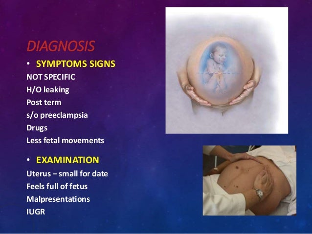 low amniotic fluid medical term