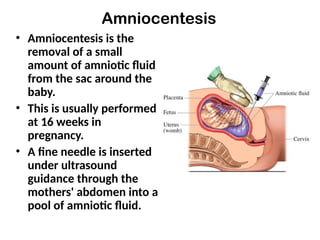 Amniocentesis
• Amniocentesis is the
removal of a small
amount of amniotic fluid
from the sac around the
baby.
• This is usually performed
at 16 weeks in
pregnancy.
• A fine needle is inserted
under ultrasound
guidance through the
mothers' abdomen into a
pool of amniotic fluid.
 